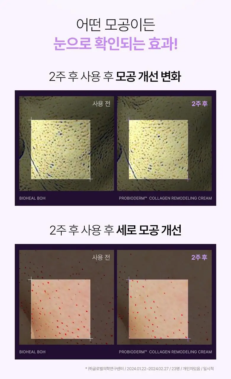 [기프트세트] 바이오힐보 프로바이오덤 콜라겐 리모델링 스킨케어 3종 기획 상세페이지 32